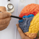 Early Warning Signs of Traumatic Brain Injury After a Texas Car Accident